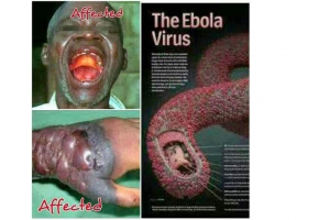 TP.HCM khẩn trương đối phó dịch bệnh Ebola